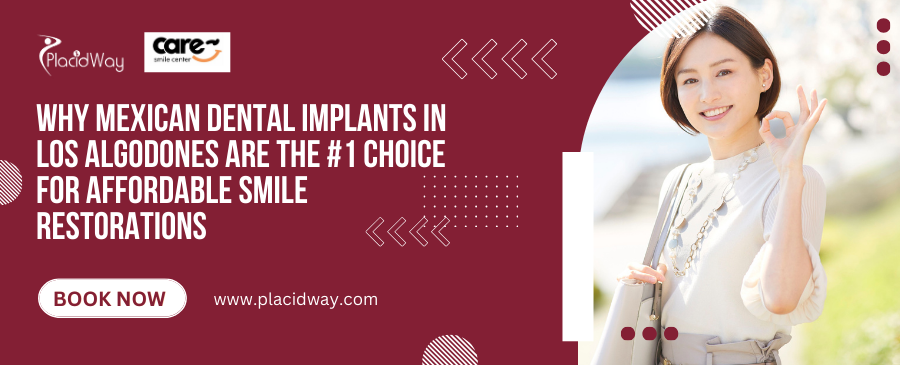 Are Mexican Dental Implants in Los Algodones Your Top Choice for Affordable Smile Restorations?