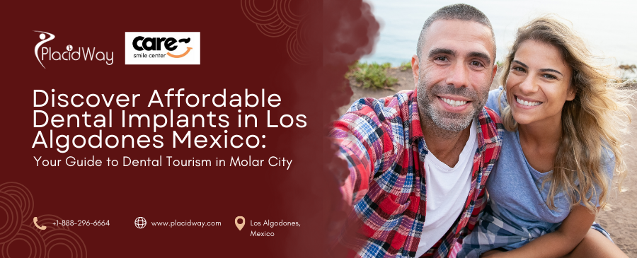 Are Affordable Dental Implants in Los Algodones, Mexico, Your Best Option?