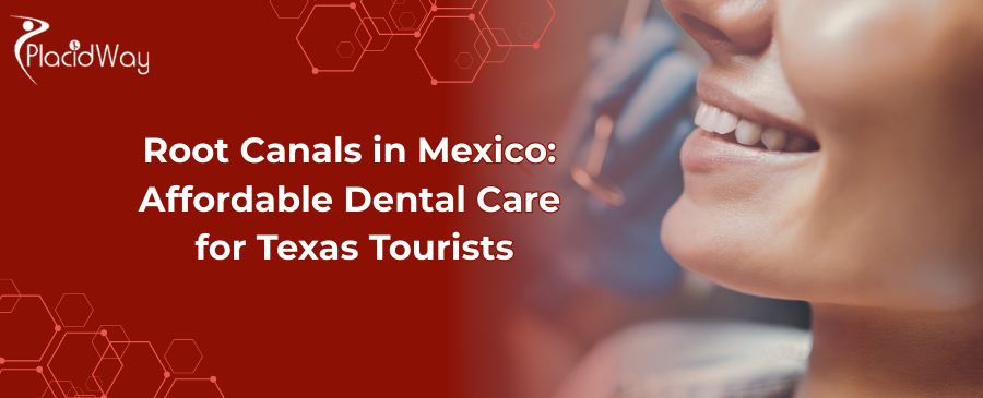 Are Root Canals in Mexico the Smart Choice for Texas Tourists?