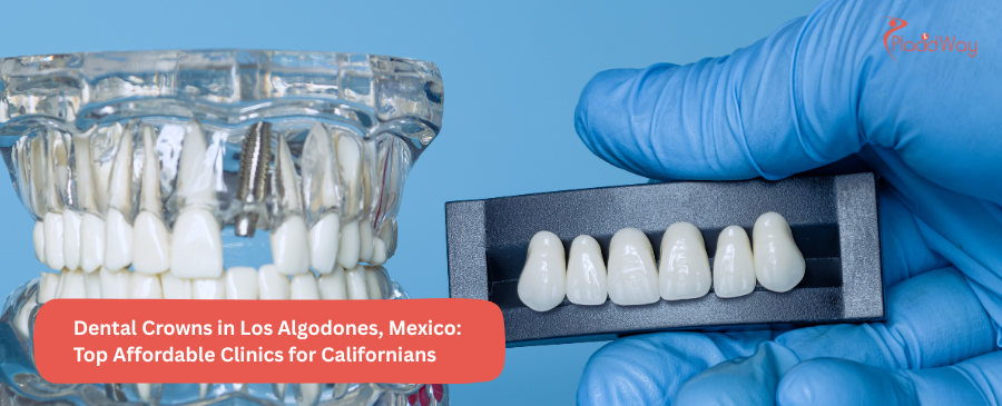 Seeking Affordable Dental Crowns in Los Algodones, Mexico?