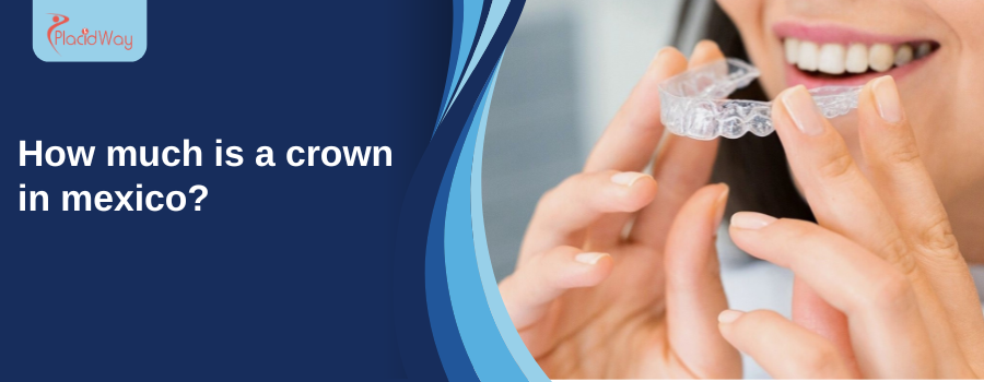 How Much Does a Dental Crown Cost in Mexico?