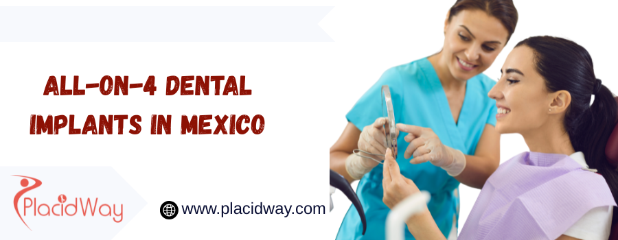 How Much Do All-on-4 Dental Implants Cost in Mexico?