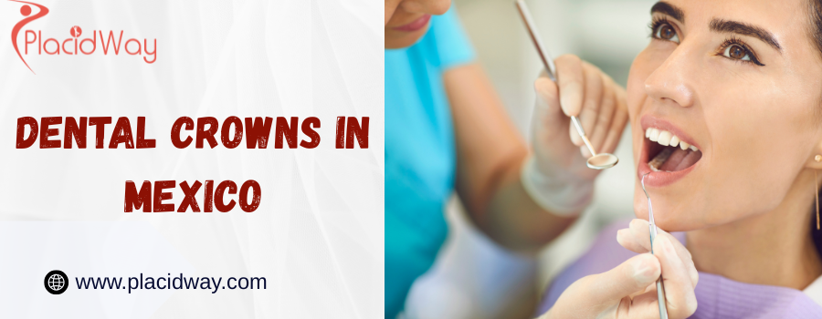 Is it Safe to Get Crowns in Mexico?