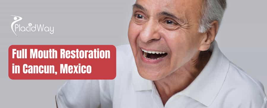 What is the Cost of a Full Mouth Restoration in Cancun, Mexico?