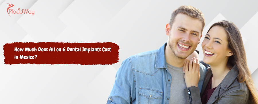How Much Do All on 6 Dental Implants Cost in Mexico?