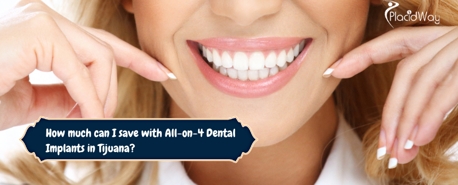 How Much Can I Save with All-on-4 Dental Implants in Tijuana?