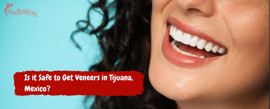 Is Getting Dental Veneers in Tijuana, Mexico, Really Safe?