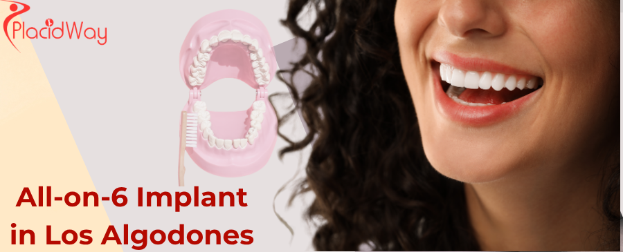 How Long Does the All-on-6 Implant Surgery Take in Los Algodones?