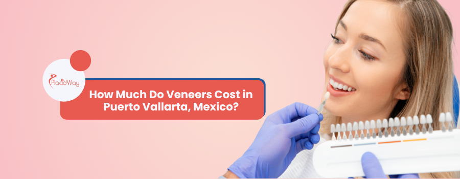 How Much Do Veneers Cost in Puerto Vallarta, Mexico?