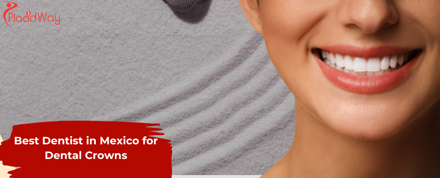 Who is the Best Dentist in Mexico for Dental Crowns to Restore Your Smile?