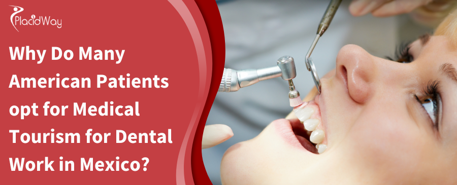 Why Do American Patients Choose Mexico for Dental Work?