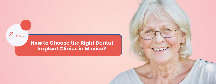 What are the Key Steps to Choose the Right Dental Implant Clinics in Mexico?