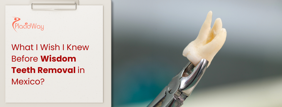 What I Wish I Knew Before Wisdom Teeth Removal in Mexico?