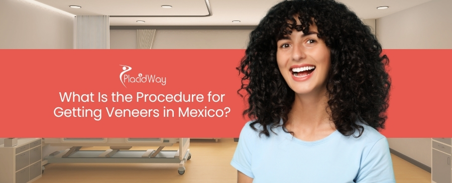 What Is the Procedure for Getting Veneers in Mexico?