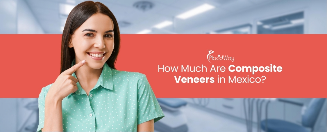 How Much Are Composite Veneers in Mexico, and Are They Worth It?