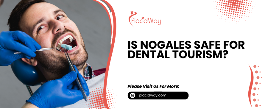 Is Nogales Safe for Dental Tourism? Your Comprehensive Guide to Peace of Mind