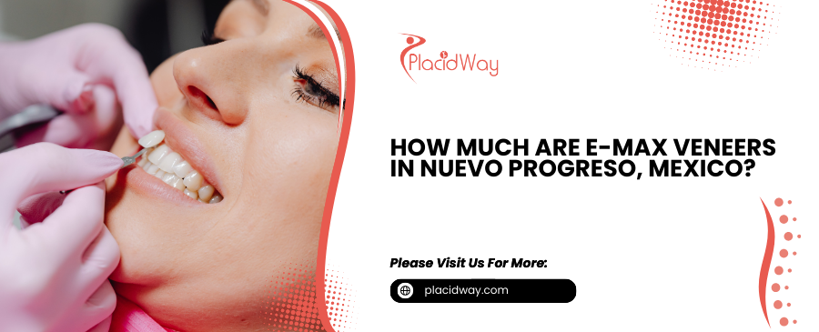 How Much Are E-max Veneers in Nuevo Progreso, Mexico, Really?