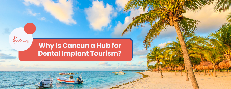 Why Is Cancun a Top Destination for Dental Implant Tourism?