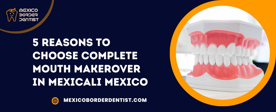 5 Reasons to choose Complete Mouth Makerover in Mexicali Mexico