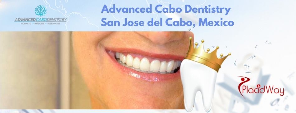 Advanced Cabo Dentistry San Jose del Cabo, Mexico