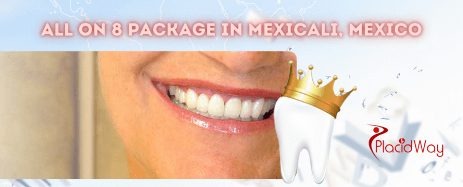 Affordable All on 8 Package in Mexicali Mexico