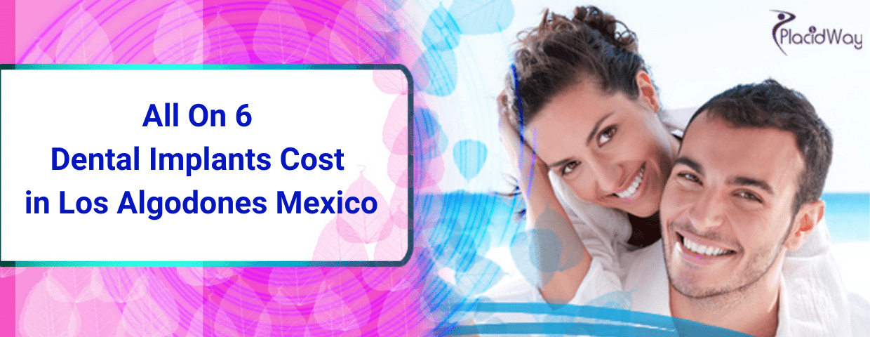 All on 6 dental implants cost in los algodones mexico