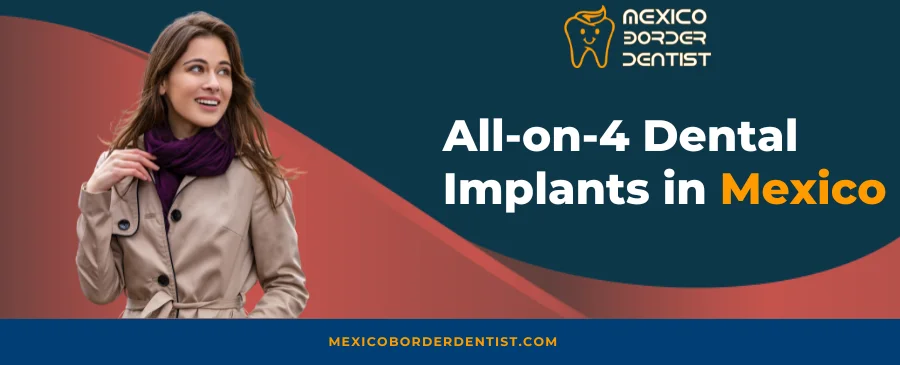 All on 4 Dental Implants in Mexico