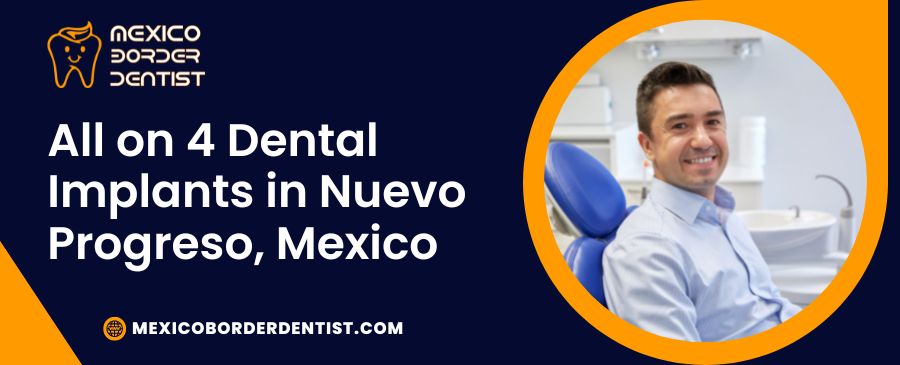 All on 4 Dental Implants in Nuevo Progreso, Mexico
