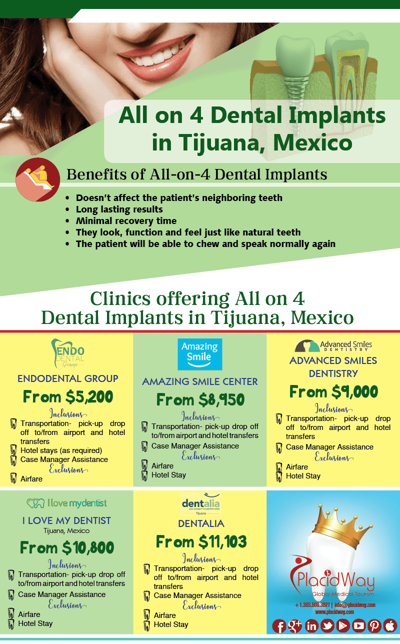 All on 4 Dental Implants in Tijuana, Mexico
