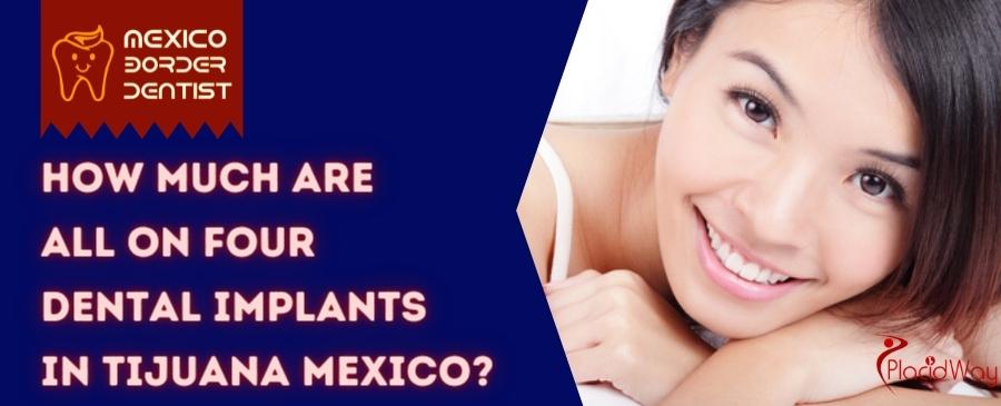 all on 4 dental implants in Tijuana MEXICO