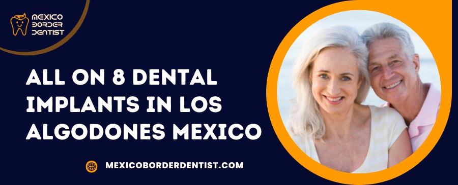 All on 8 Dental Implants in Los Algodones Mexico