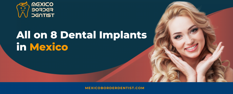 All on 8 Dental Implants in Mexico