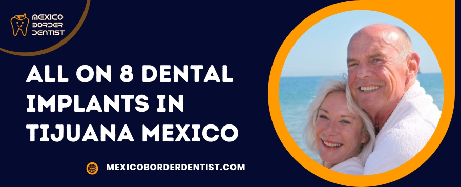 All on 8 Dental Implants in Tijuana Mexico