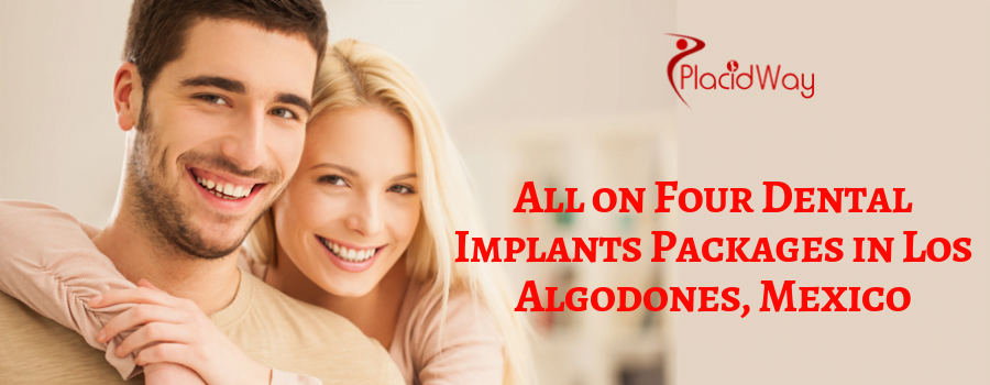 Los Algodones All on 4 Dental Implants in Mexico