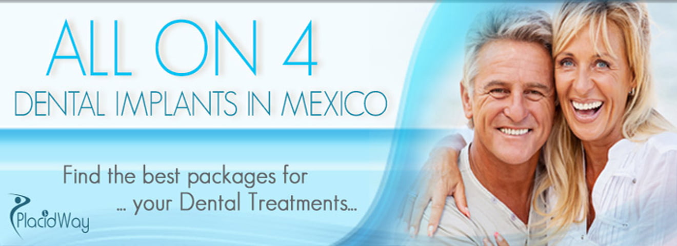 Paquete Todo en 4 Implantes Dentales en Tijuana Mexico