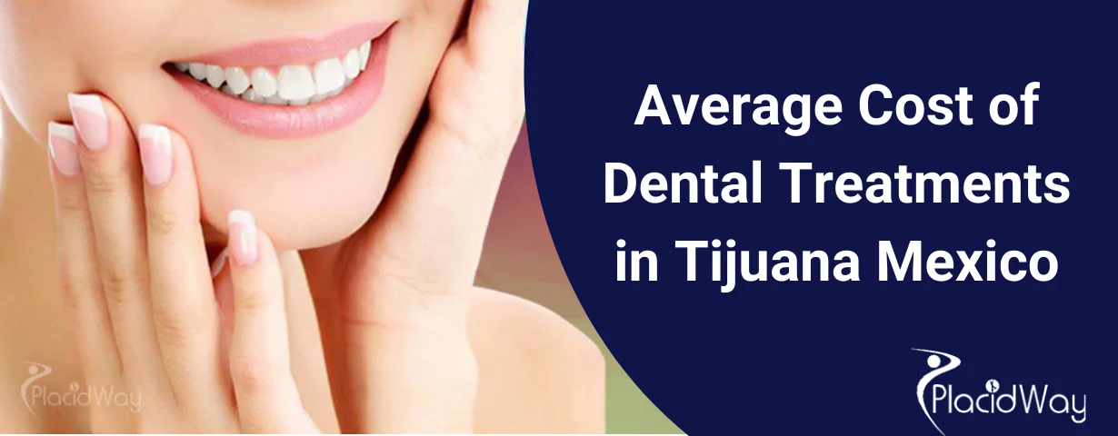 Average Cost of dental treatments in tijuana mexico