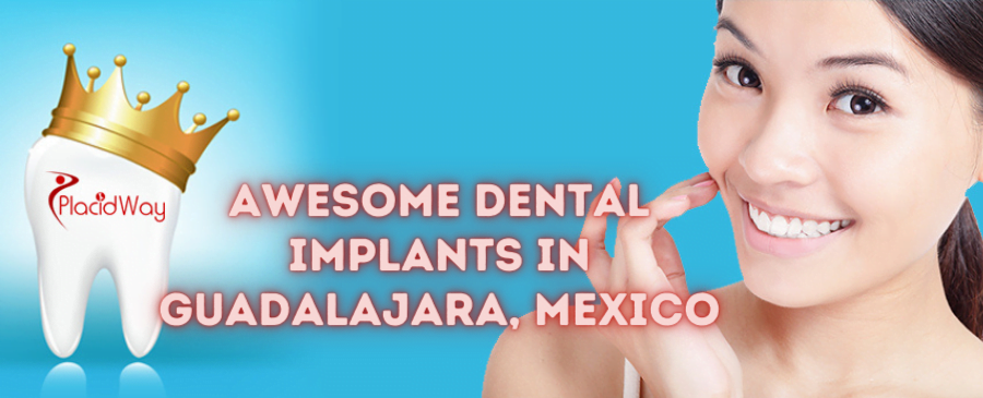 Awesome Dental Implants in Guadalajara, Mexico