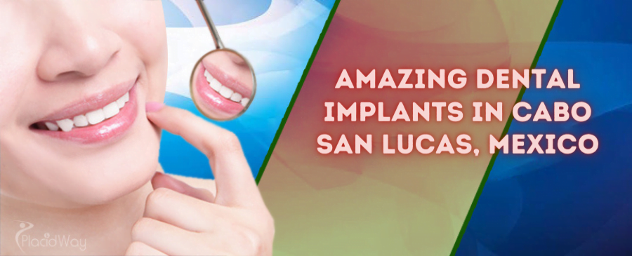 Amazing Dental Implants in Cabo San Lucas, Mexico