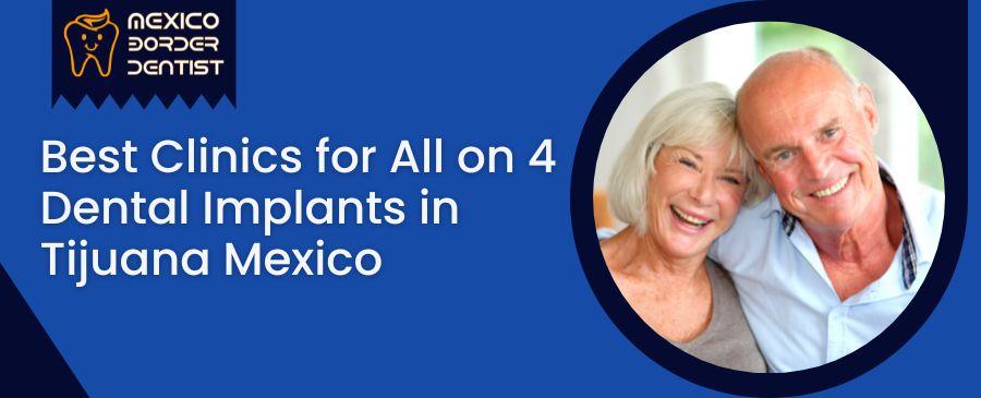 All on 4 Dental Implants in Tijuana Mexico