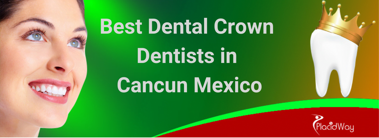 Best Dental Crown Dentists in Cancun Mexico