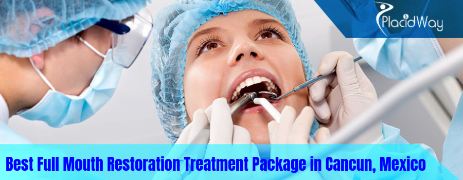Best Full Mouth Restoration Treatment Package in Cancun, Mexico-