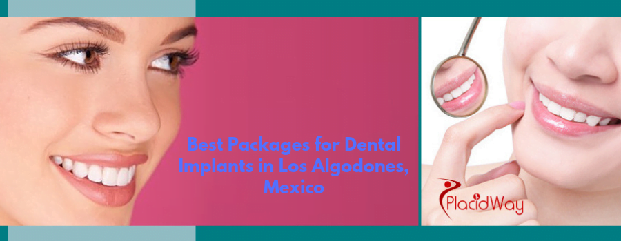 Best Packages for Dental Implants in Los Algodones, Mexico