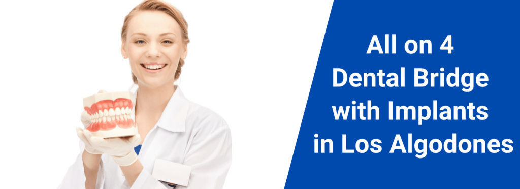 All on 4 Dental Bridge with Implants in Los Algodones