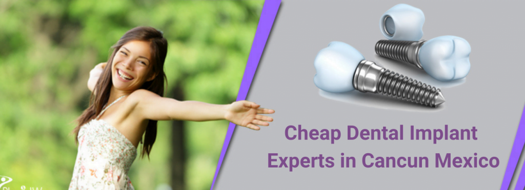 Cheap Dental Implant Experts in Cancun Mexico