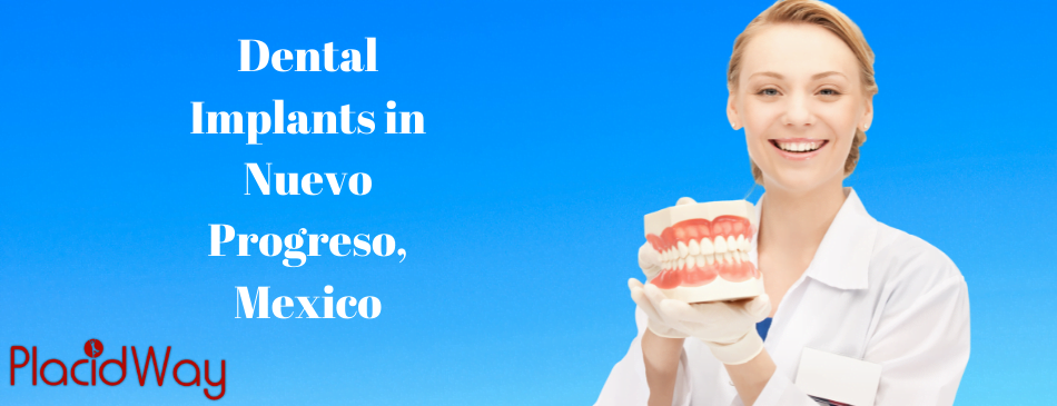 Dental Implants in Nuevo Progreso, Mexico