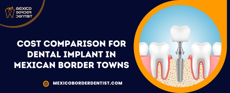 Cost Comparison for Dental Implant in Mexican Border Towns