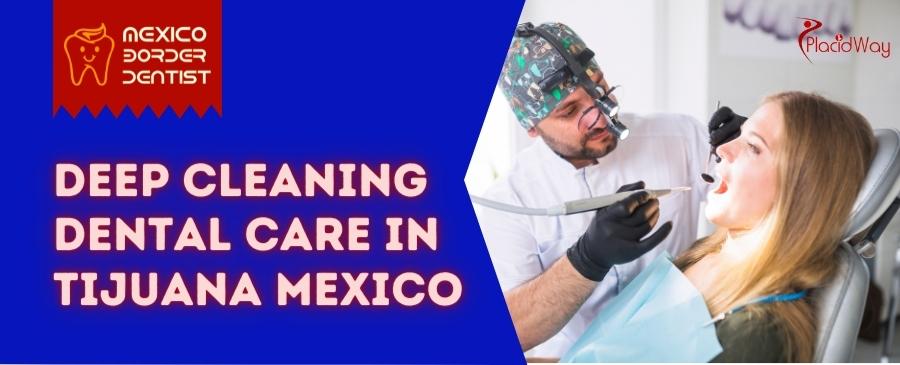 Deep Cleaning Dental Care in Tijuana Mexico