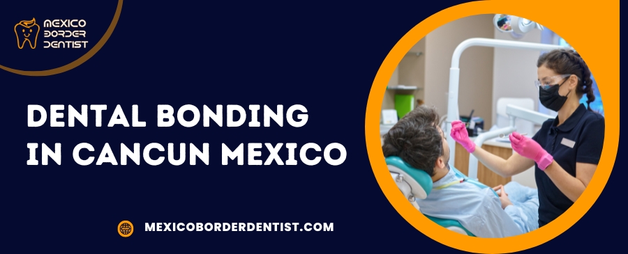 Dental Bonding in Cancun Mexico
