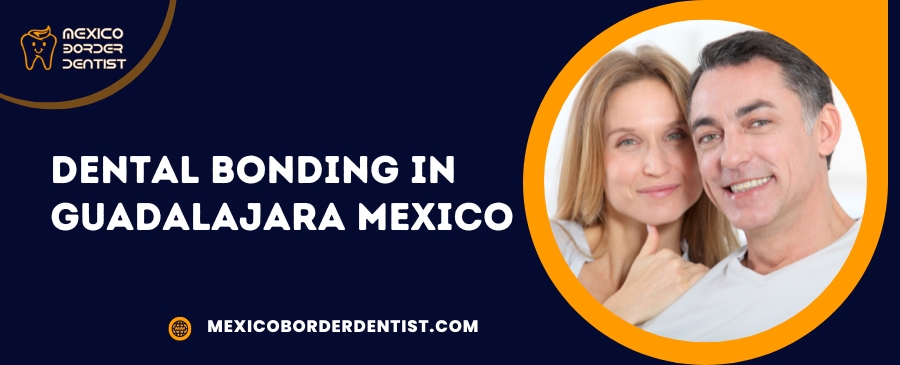 Dental Bonding in Guadalajara Mexico