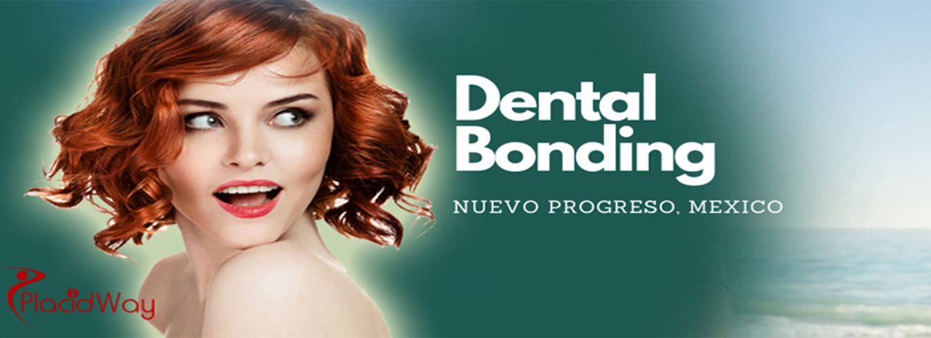 dental bonding in mexico